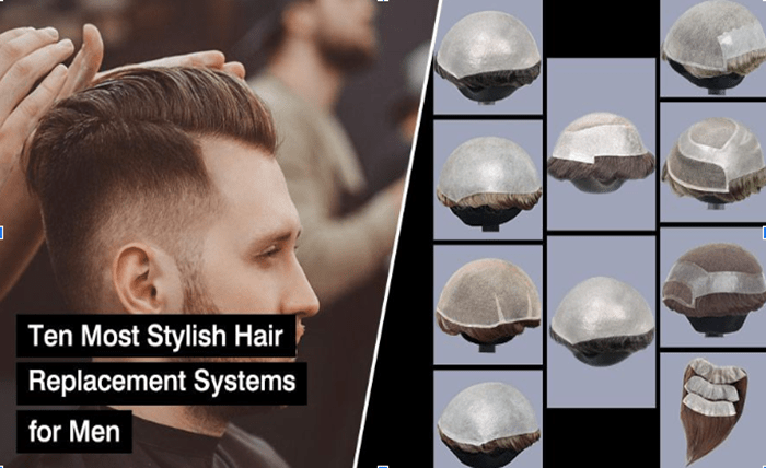 Do Celebrities Wear Hair Systems? Here’s What You Didn’t Know Screenshot 21 1